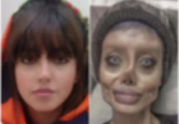 50 Kali Operasi Plastik Hingga Berat Badan Turun 40 Kg, Begini Kabar Penggemar Angelina Jolie Ini Sekarang: Ditangkap Polisi dan Ungkap Kehidupan Kelam