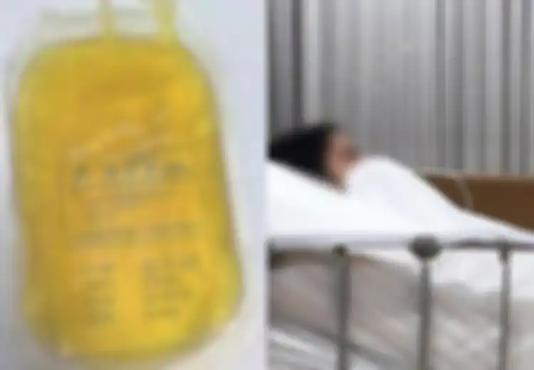 Mengerikan! Darah Wanita Ini Berubah Jadi Kuning Karena Sering Makan Makanan yang Disukai Banyak Orang Ini, Dokter pun Sampai Terkejut!