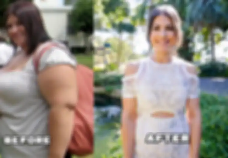 Saking Gemuknya Wanita Ini Pakai Baju Hamil untuk Menutupinya, Kini Ia Berhasil Turunkan Berat Badannya, Apa Rahasianya? 