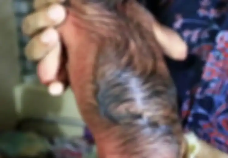 Miliki Wajah yang Tak Biasa, Bayi Ini Bikin Orang Terkejut Sekaligus Sedih