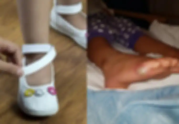 Gadis 4 Tahun Kena Infeksi Mematikan Setelah Coba Sepatu Tanpa Kaus Kaki, Bisakah Hal Itu Terjadi pada Semua Orang?