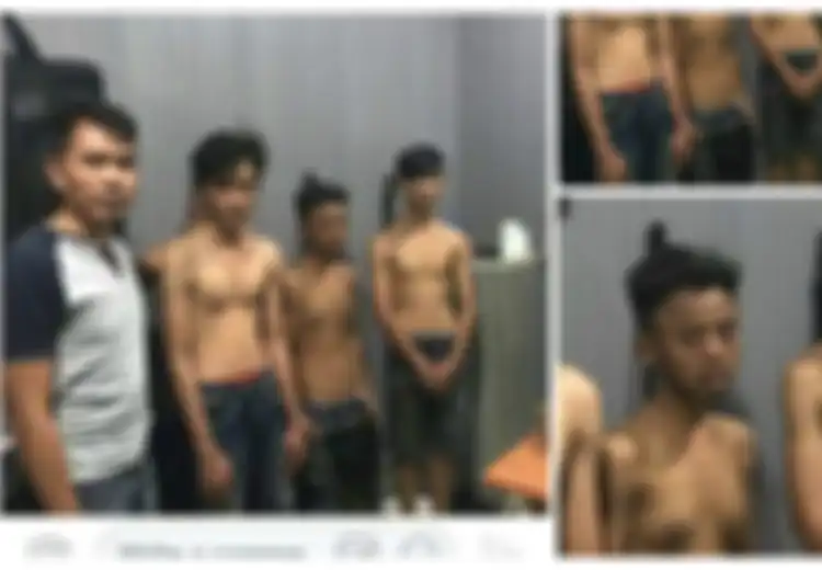 Viral! Foto Pemuda Miliki Payudara, Ternyata Ini Penyebab dan Gejalanya