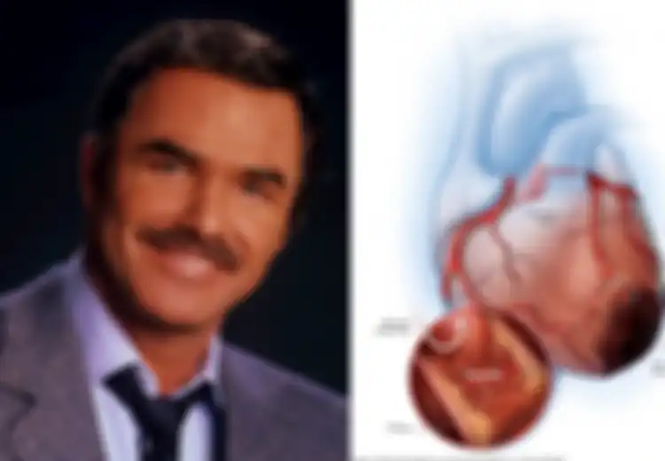 Burt Reynolds Meninggal Karena Serangan Jantung: 1 Bulan Sebelum Serangan Jantung Tubuh Berikan 6 Tanda Ini