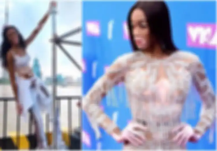 Model Victoria's Secret Winnie Harlow Idap Vitiligo, Ini Penyebab dan Komplikasi dari Penyakit Ini
