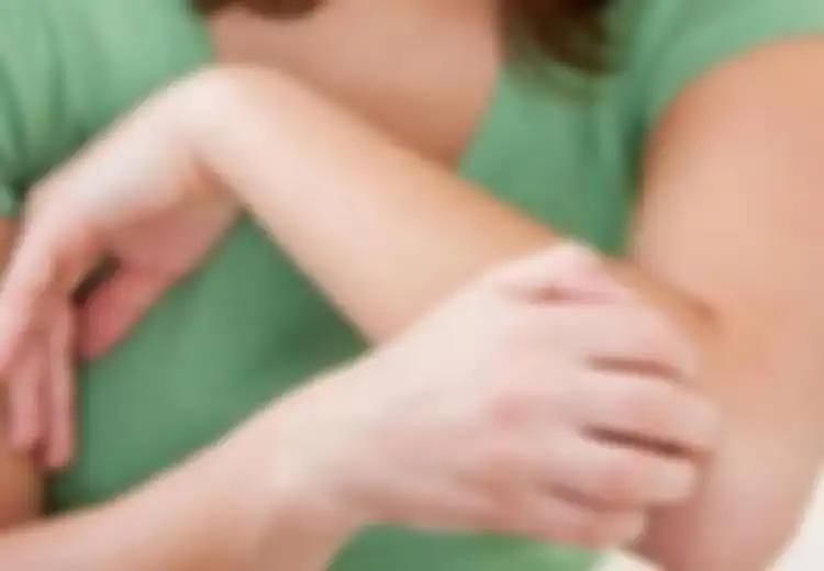 Pantangan Biduran dan Makanan yang Tak Boleh Dikonsumsi Agar Tak Kambuh Lagi