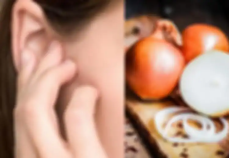 Inilah 2 Cara Mudah Gunakan Bawang untuk Obati Infeksi Telinga
