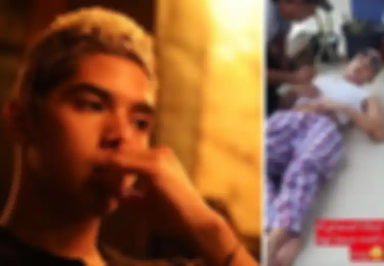 Ahmad Dhani Takut Al Mengidap Steven Johnsons Syndrome, Penyakit Apa Itu?