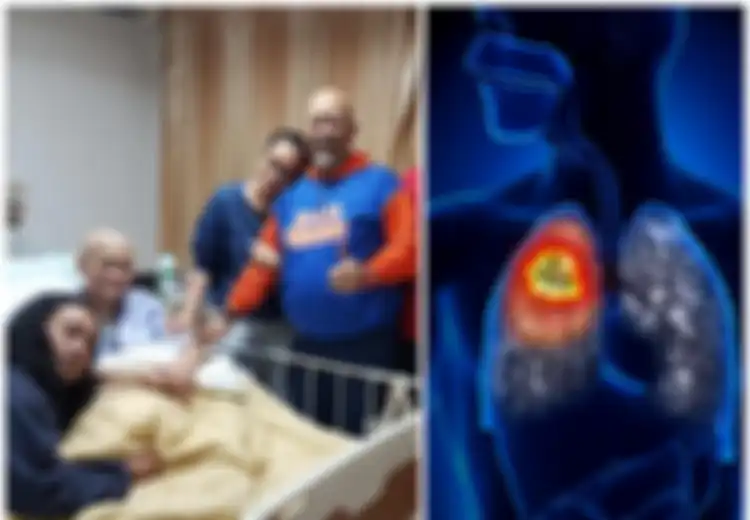 Istri Indro Warkop Idap Kanker Paru-paru: Ini Gejala Kanker Paru-paru yang Sering Tak Disadari