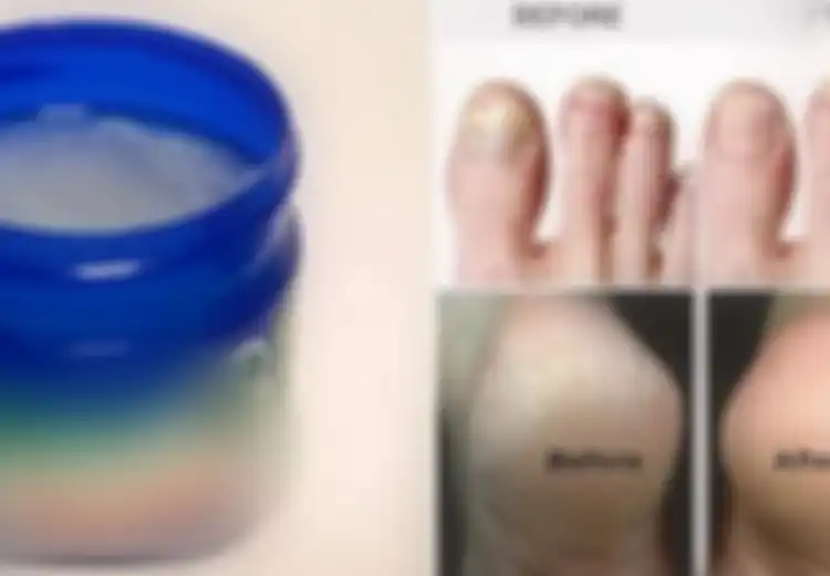 10 Manfaat Vaporub yang Jarang Diketahui, Bisa Atasi Tumit Pecah-pecah hingga Hilangkan Selulit