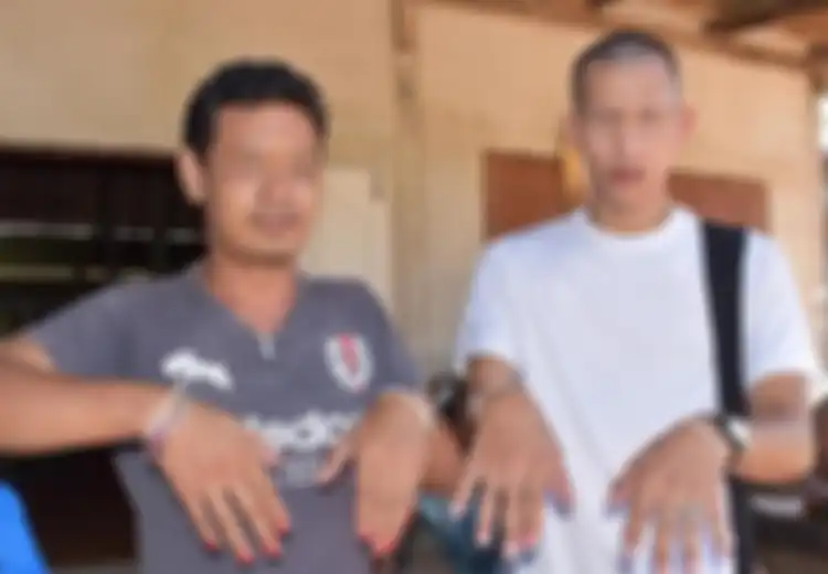 Takut Dikejar Hantu Janda, Pria di Thailand Ramai-ramai Cat Kukunya
