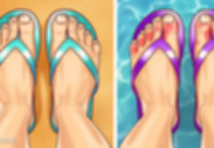 Cek 9 Masalah Kesehatan dari Kaki, Bagaimana dengan Milik Anda?