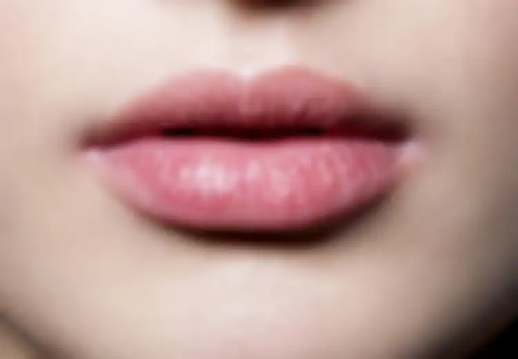 5 Bahan Alami Untuk Atasi Bibir Pecah-pecah, Bisa Anda Coba Lho!