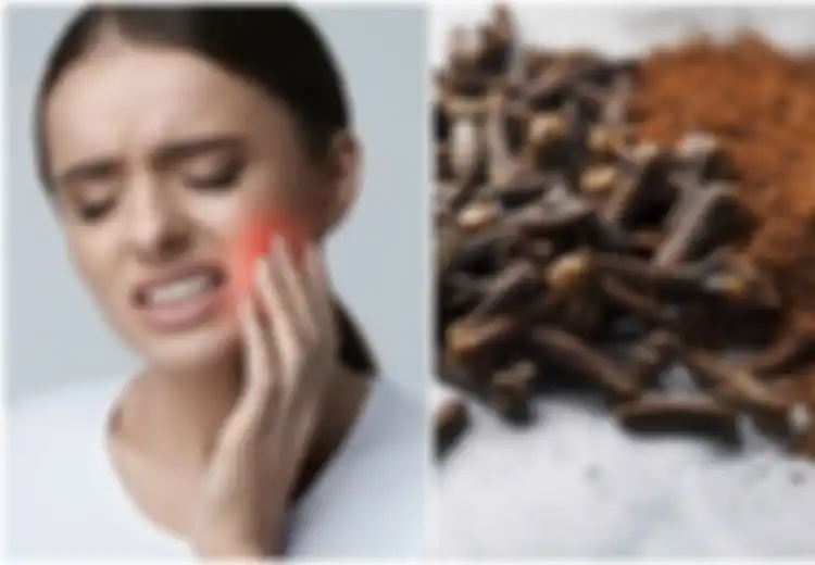 3 Cara Menggunakan Cengkeh untuk Meredakan Sakit Gigi dalam Hitungan Menit