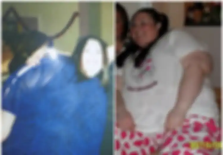 Tolak Operasi, Wanita Ini Berhasil Atasi Obesitas Ratusan Kilogram, Tampilannya Sekarang Bikin Pangling!