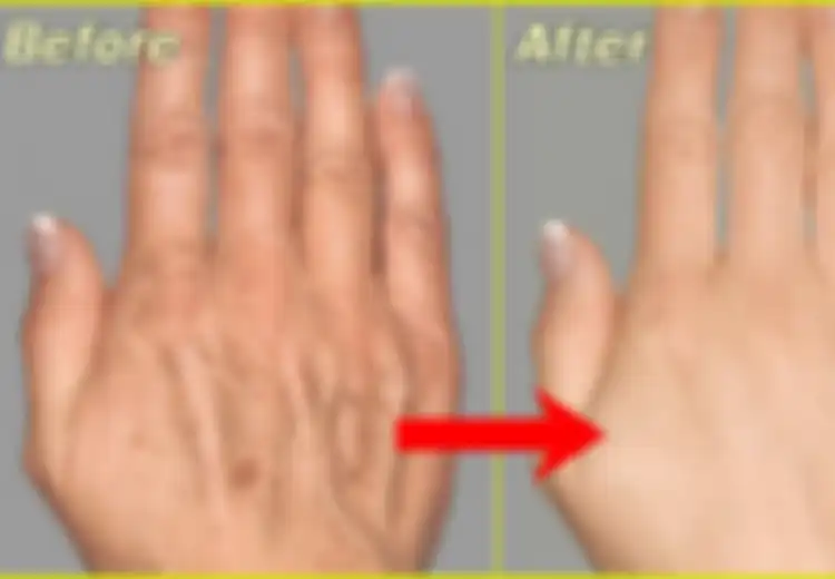 Tangan Mulai Keriput? Tak Perlu Sedih, Atasi dengan Cara Berikut Ini, Mudah!