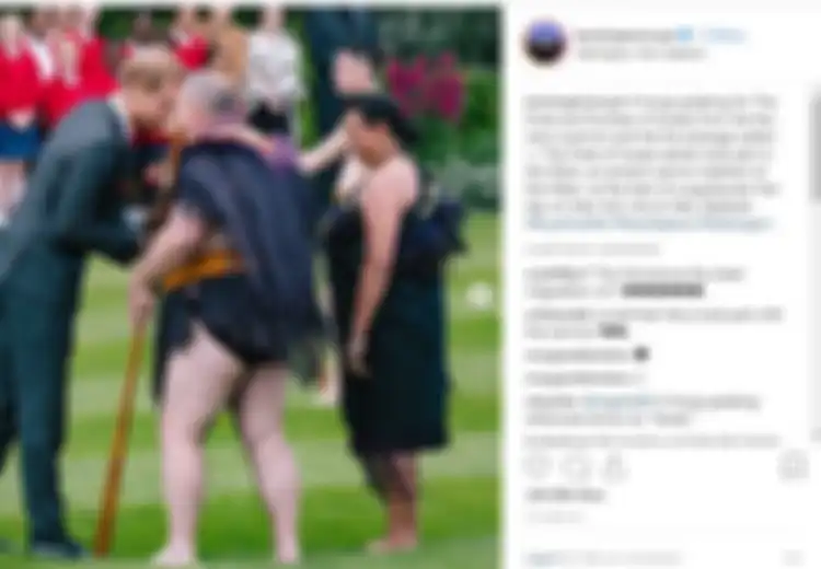 Pangeran Harry Diprediksi Akan Alami Kebotakan, Ini 5 Cara Atasi Kebotakan