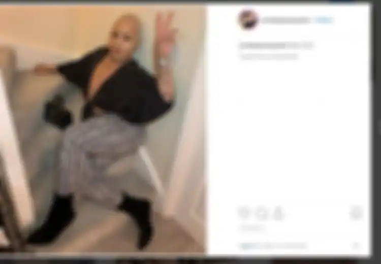 Lakukan Operasi Pengangkatan Bokong Berbiaya Rp157 Juta, Pria Penggemar Berat Kim Kardashian Ini Nyaris Tewas