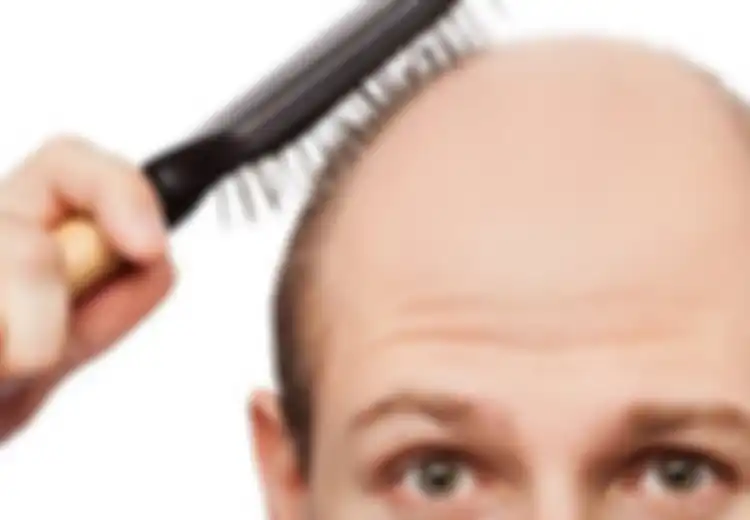 Merasa Tidak Percaya Diri Karena Rambut Tipis Lalu Gunakan Penumbuh Rambut, Ingat! Ini Bisa Bikin Pria Alami Impotensi di Usia Muda, Berhati-hatilah!