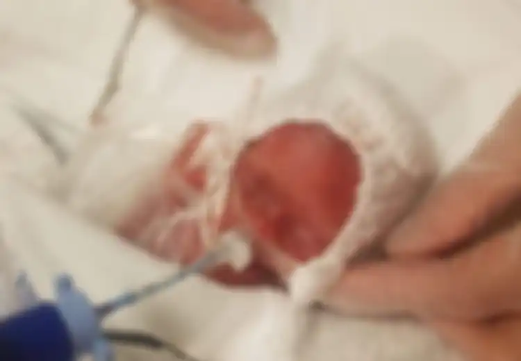 Lahir Seukuran Botol Kecap, Bayi Ini Kini Sudah Bisa Pulang untuk Sambut Natal Bersama Keluarganya