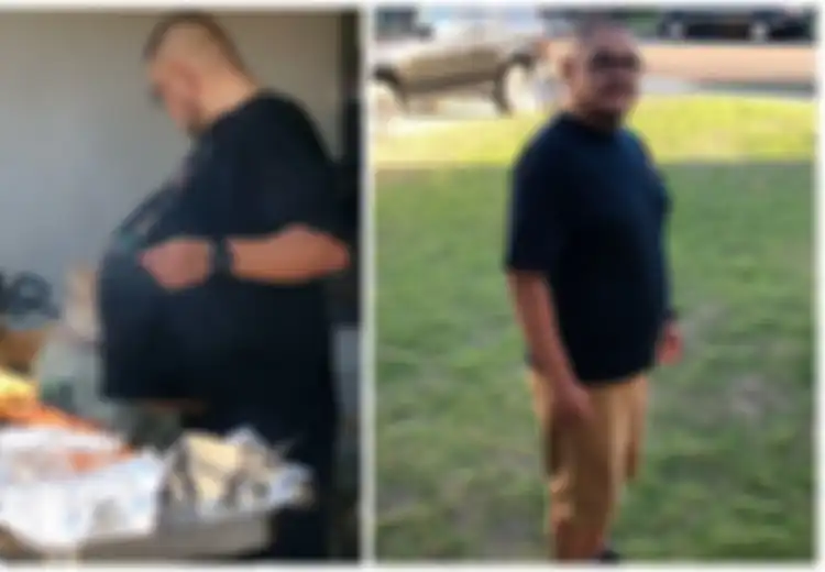 Jangan Abaikan Perut Buncit, Pria Ini Tak Sadar 'Perut Buncitnya' Ternyata Tumor Seberat 34 kg