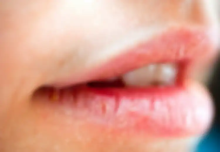 Bibir Kering dan Pecah-pecah, Jangan Khawatir, Atasi dengan 4 Bahan Rumahan Ini