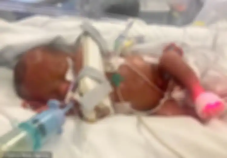 Lahir dengan Berat Kurang Dari 1 Kilogram dan Diprediksi Alami Kerusakan Otak, Bayi Ini Tumbuh Mengagumkan!