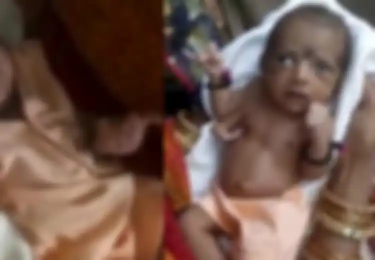 Terlahir dengan Tiga Tangan, Bayi Ini Dianggap Reinkarnasi Dewa hingga Orang-orang Mendatanginya