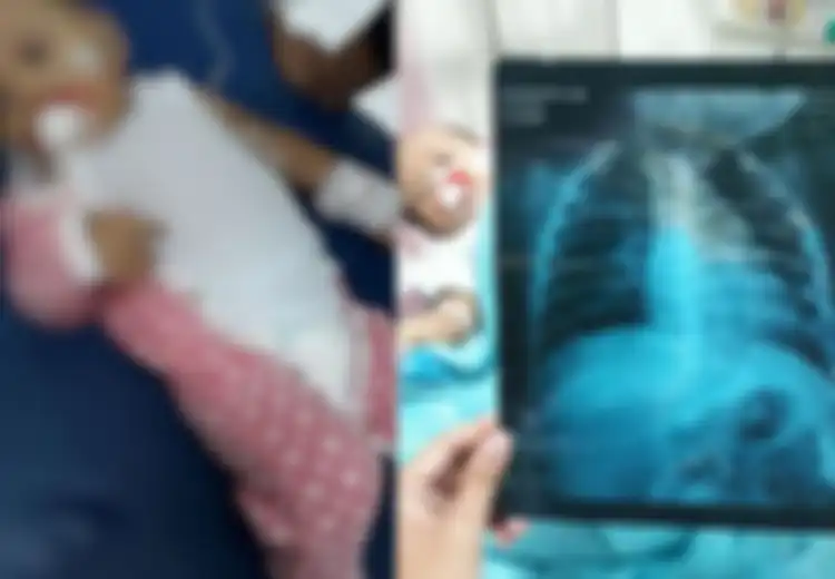 Waspada, Asap Rokok yang Menempel pada Baju Bisa Picu Pneumonia pada Balita, Peringatan untuk Para Ayah Perokok
