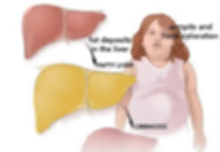 Penyakit Perlemakan Hati? Obati dengan Buah-buahan Terbaik Berikut