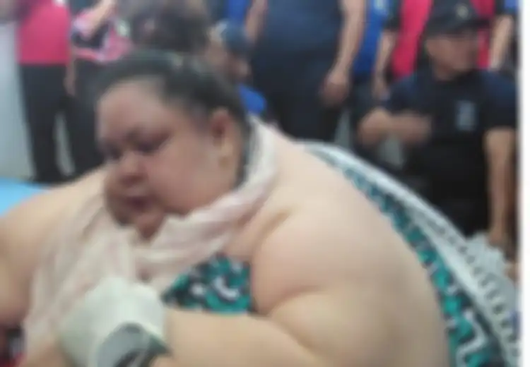 Menilik Kasus Titi Wati, Mungkinkah Obesitas karena Gorengan dan Air Es?