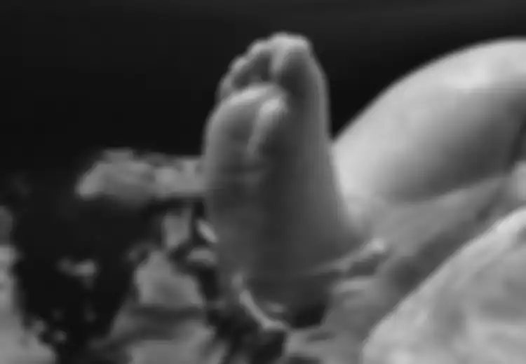 Ngeri, Bayi 'Terpenggal' saat akan Dilahirkan karena Perawat Menarik Terlalu Keras