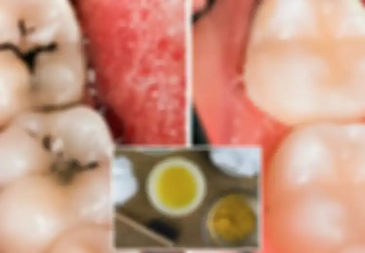 8 Cara Merawat Gigi dengan Bahan Alami dan Metode Sederhana yang Murah