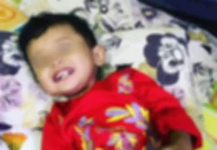 Digigit Serangga, Kaki Anak Ini Terinfeksi Bakteri Pemakan Daging dan Terancam Diamputasi