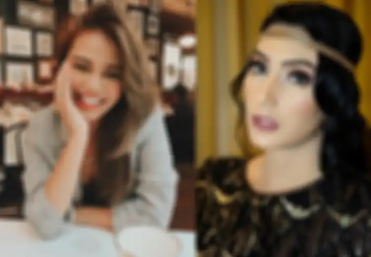 Ingin Coba Veneer Gigi yang Banyak Dilakukan para Artis? Ini Bocoran Harganya dari Dokter Ahli!
