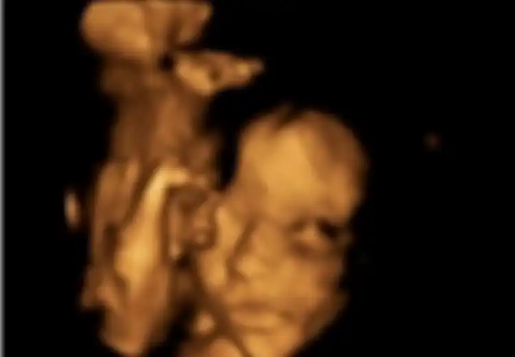 Bayi 24 Minggu Dikeluarkan dari Janin, Kemudian Dimasukkan Kembali ke dalam Kandungan, Ini Alasannya