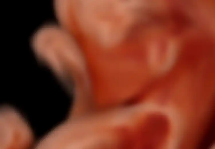 Arumi Bachsin Alami Keguguran: Ini 11 Faktor Risiko Ibu Hamil yang Bisa Alami Keguguran