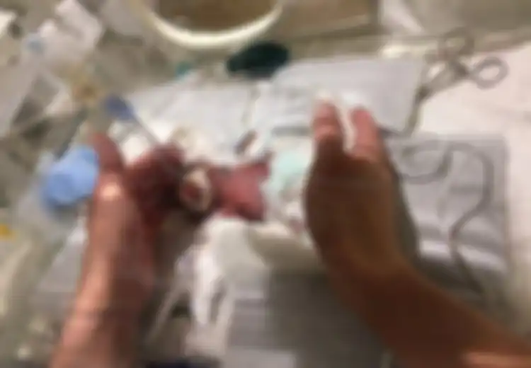 Kisah Bayi Terkecil di Dunia Asal Jepang, Hanya Seukuran Telapak Tangan Orang Dewasa!