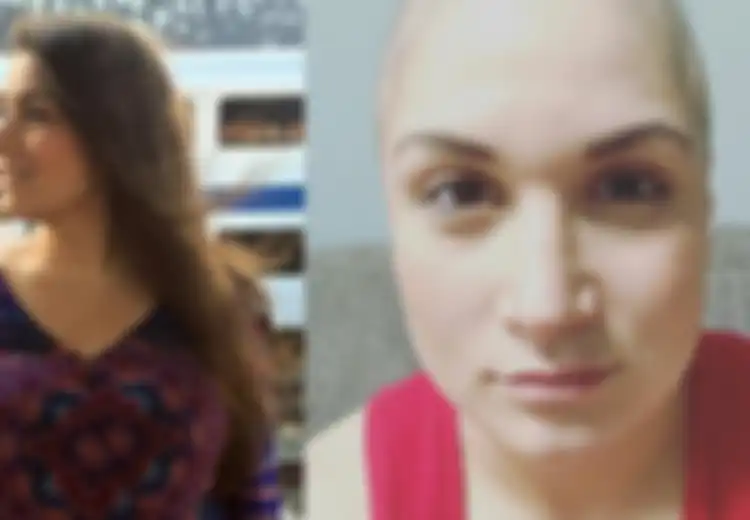 Sakit Perut Selama 9 Tahun, Wanita Ini Baru Tahu Ternyata Ia Menderita Kanker Ovarium