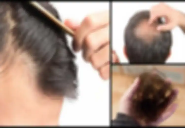 4 Kondisi Rambut Ini Dapat Ungkap Kesehatan Anda, Yuk Cek Sekarang!