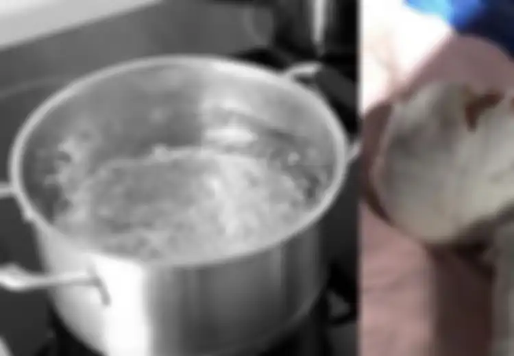 Duh, Bayi Ini Menderita Luka Bakar Mengerikan Setelah Jatuh ke Dalam Air Mendidih