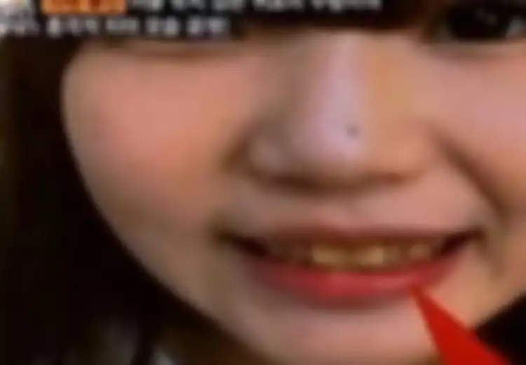Berparas Cantik, Siapa Sangka Gadis Ini Tidak Pernah Gosok Gigi Selama 10 Tahun, Begini Kondisi Giginya!