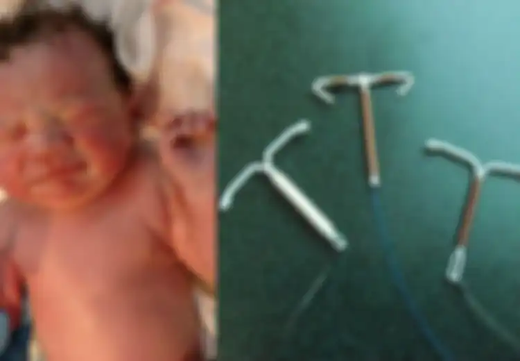Viral Bayi Lahir dengan Menggenggam Alat KB Spiral Ibunya,  Alat KB Spiral Tak Efektif?