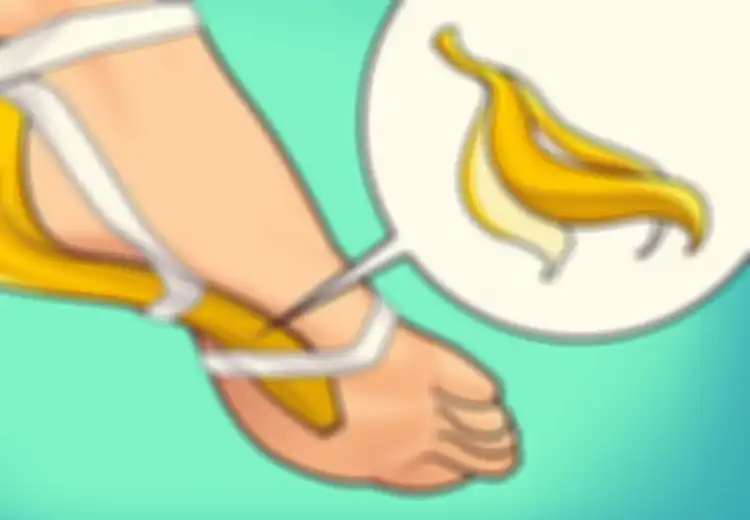 Ingin Obati Mata Ikan di Kaki? Cukup Beri Kulit Pisang Selama 3 Hari dan Dapatkan Hasil Menakjubkan