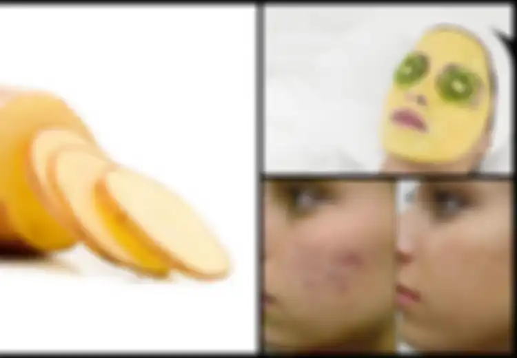 Masker Kentang, Solusi Alami untuk Pemutih Kulit Alami, Begini Cara Pakainya!