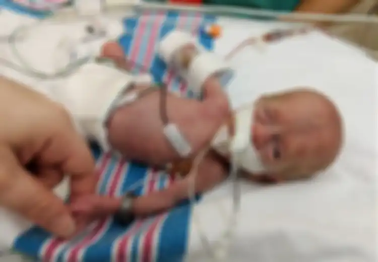Walau Berat Badannya Hanya 310 Gram, Bayi Mungil Ini Dapat Bertahan Hidup dan Pulang dari NICU