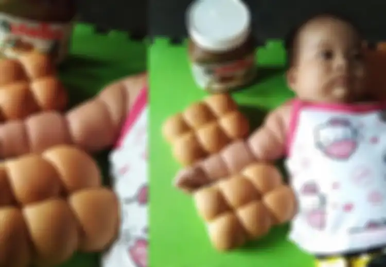 Jangan Tertawa Lihat Foto Bayi dengan Lengan Seperti Roti Sobek Ini, Sebab Ada Bahaya yang Mengancam Bayi Tersebut
