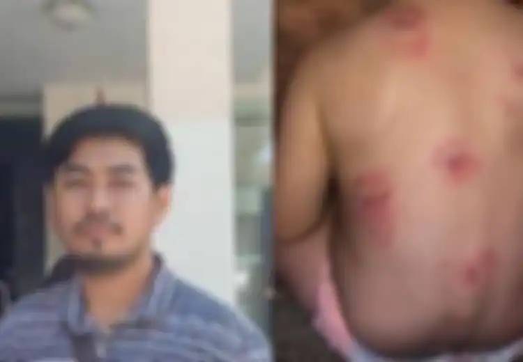 Dengan Tangan dan Mulut Membiru, Bayi 3 Bulan Tewas di Tempat Penitipan Anak