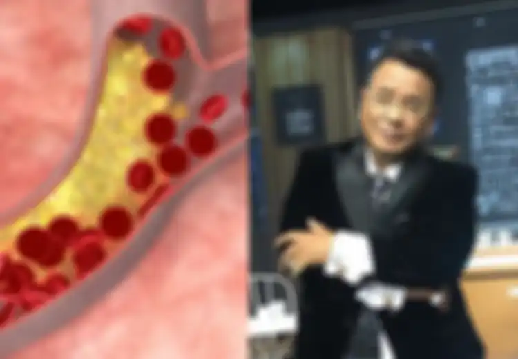 Hotman Paris Hutapea Pernah Didiagnosa Penyempitan Pembuluh Darah: Ini Gejala, Faktor Risiko dan Pencegahannya