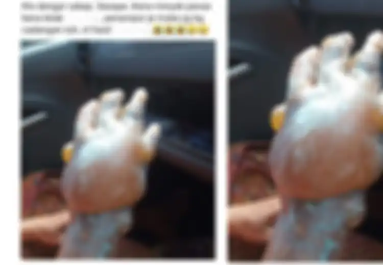 Diolesi Pasta Gigi, Tangan yang Terbakar Ini Berubah Mengerikan, Ternyata Inilah Bahaya Oleskan Pasta Gigi pada Luka Bakar
