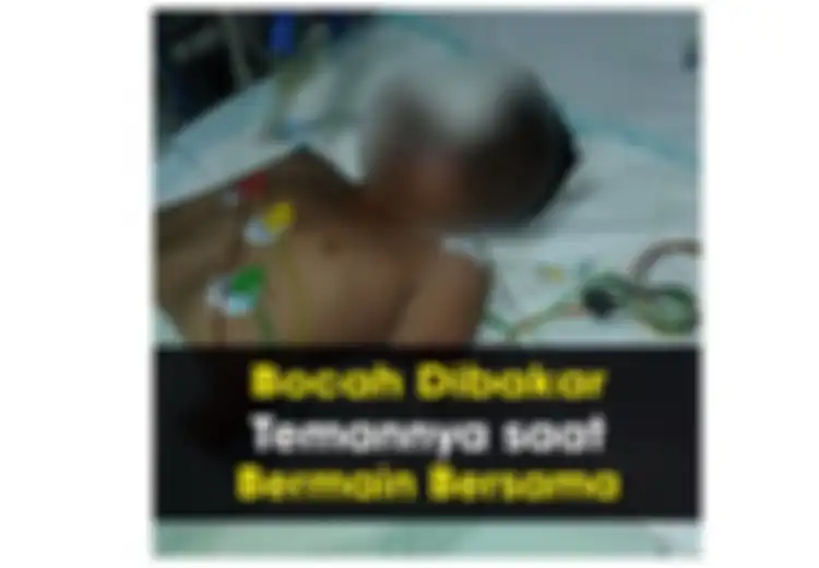 Bocah 10 Tahun Dibakar Temannya karena Dendam: Ayo, Ajari Anak untuk Meminta Maaf Agar Mereka Tak Tumbuh Jadi Pendendam